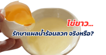 ไข่ขาวใช้รักษาแผลน้ำร้อนลวกได้ จริงหรือ?